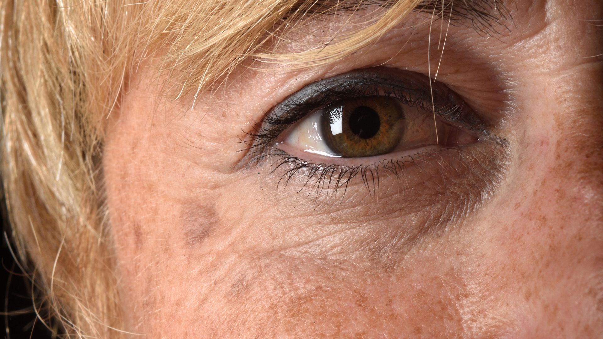 ¿Manchas alrededor de los ojos? A qué se deben y cómo las eliminamos