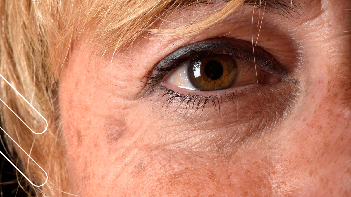 ¿Manchas alrededor de los ojos? A qué se deben y cómo las eliminamos