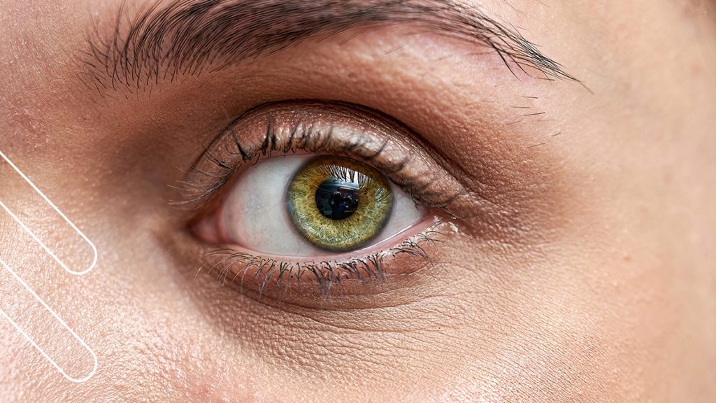 oculoplastia en Bilbao