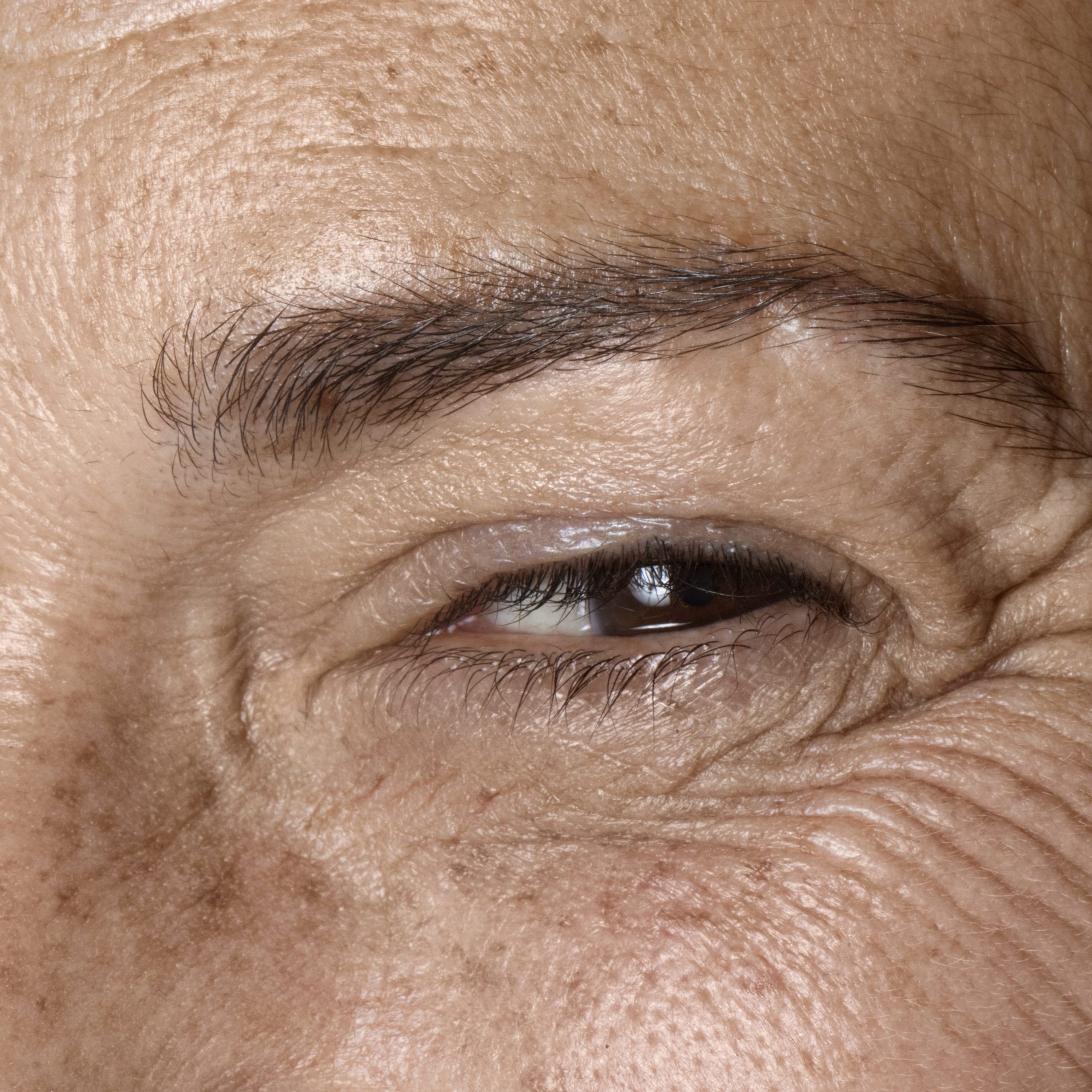 sueño y estética, estética periocular