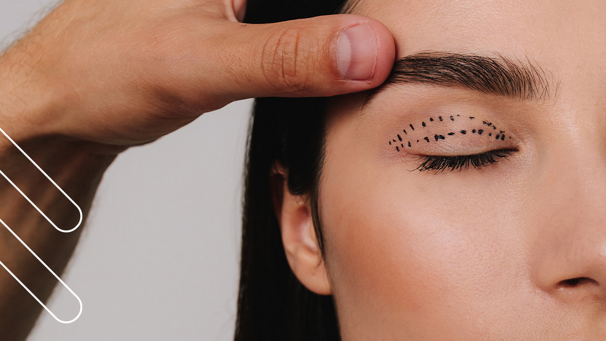 cicatriz tras una blefaroplastia